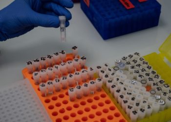 Hepatitis "unbekannten Ursprungs" breitet sich aus – Dutzende Fälle bei Kindern