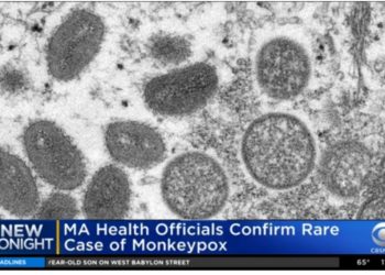 Es geht wieder los: Die Biden-Administration kauft Millionen von Dosen des Affenpocken-Impfstoffs, nachdem der Fall in Massachusetts bestätigt wurde – Gesundheitsbeamte untersuchen derzeit den zweiten potenziellen Fall in NYC