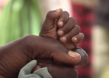 Während das COVID-Virus Kinder größtenteils verschonte, tat Dr. Fauci nicht … Tony Fauci tötete 300.000 bis 900.000 Kinder mit seinen Lockdowns, hauptsächlich in Afrika