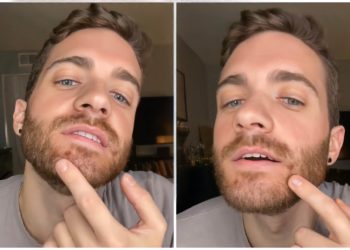 Schauspieler, der positiv auf Affenpocken getestet wurde, verprügelt US CDC wegen langsamer Reaktion