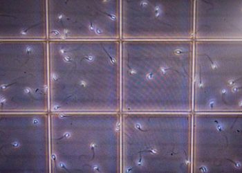 Spermienanzahl bei Männern sinkt weltweit – Studie