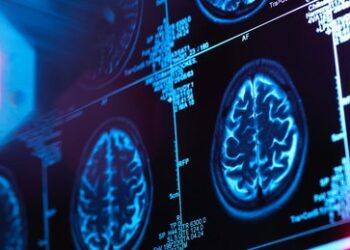 US-Regierung bringt Alzheimer mit Rassismus in Verbindung