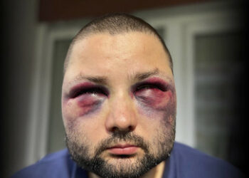 Fall des AfD-Politikers Jurca: Zwei Männer unter Tatverdacht