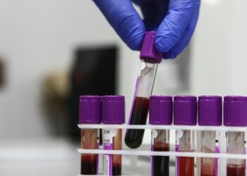 Gesundheitsministerium: Russland erreicht in fünf Jahren in der Krebsmedizin Bahnbrechendes