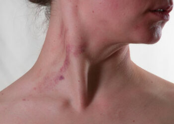 Deutschland: Gewaltdelikte gegen Frauen stiegen in den letzten Jahren um rund 90 Prozent