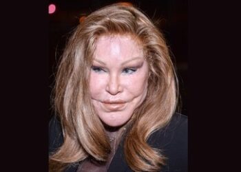 "Katzenlady" Jocelyn Wildenstein ist tot