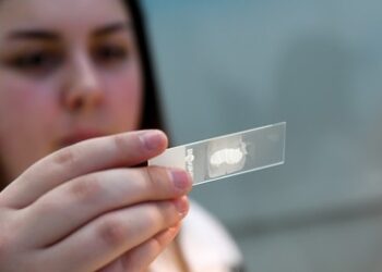 Trefferquote von bis zu 98 Prozent: Russland entwickelt ein KI-Programm zur Krebsfrüherkennung