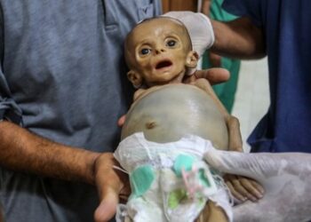 Britischer Arzt: Israel verbietet Einfuhr von Babynahrung nach Gaza und übt Schießen auf Menschen