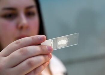 Studie: Ärzte erkennen immer seltener Krebs wegen KI-Einsatz